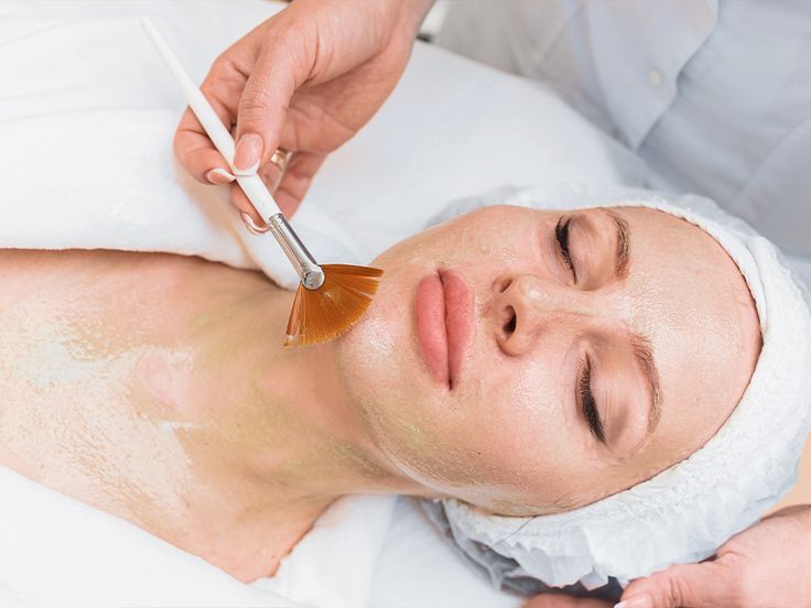 Tratamiento de Peeling Químico